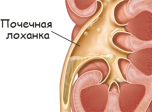 Кракен купить гашиш